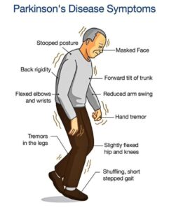 Symptoms/Signs of Parkinson's Disease